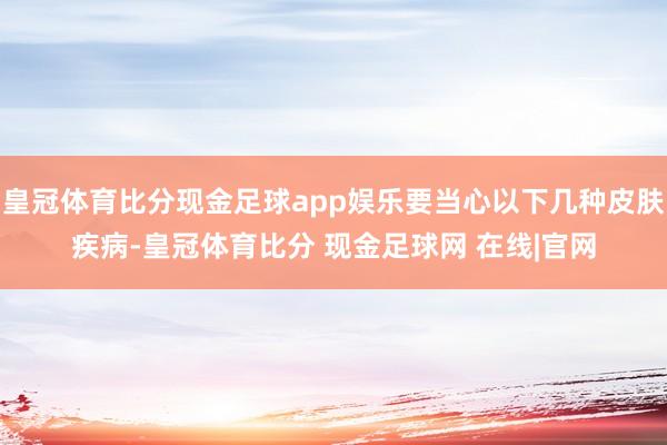 皇冠体育比分现金足球app娱乐要当心以下几种皮肤疾病-皇冠体育比分 现金足球网 在线|官网